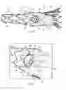 Fig. 04 - Prosthesis having pivoting fenestration