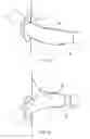 Fig. 09 - Prosthesis having pivoting fenestration