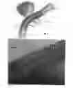 Fig. 10 - Monolithic medical devices, methods of making and using the same
