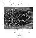 Fig. 15 - Monolithic medical devices, methods of making and using the same