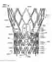 Fig. 01 - Stent features for collapsible prosthetic heart valves
