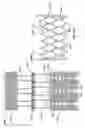 Fig. 22 - Stent features for collapsible prosthetic heart valves