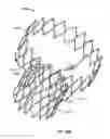 Fig. 28 - Stent features for collapsible prosthetic heart valves