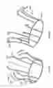 Fig. 32 - Stent features for collapsible prosthetic heart valves
