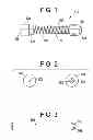 Fig. 02 - Deployment Compensator for Transcatheter Valve Delivery