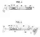 Fig. 03 - Deployment Compensator for Transcatheter Valve Delivery