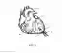Fig. 03 - METHODS AND SYSTEMS FOR CARDIAC VALVE DELIVERY