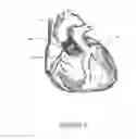 Fig. 09 - METHODS AND SYSTEMS FOR CARDIAC VALVE DELIVERY