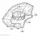 Fig. 01 - Inflatable annular sealing device for prosthetic mitral valve