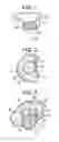 Fig. 02 - Inflatable annular sealing device for prosthetic mitral valve
