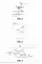 Fig. 03 - Method for Creating Incision to Improve Intraocular Lens Placement