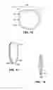 Fig. 09 - Method for Creating Incision to Improve Intraocular Lens Placement