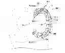 Fig. 01 - Method and implant for replacing damaged meniscal tissue
