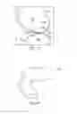 Fig. 09 - Tensioned meniscus prosthetic devices and associated methods