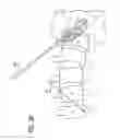 Fig. 05 - Minimally invasive method and surgical tools for trans-PSOAS approach