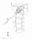 Fig. 06 - Minimally invasive method and surgical tools for trans-PSOAS approach