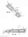 Fig. 16 - Minimally invasive method and surgical tools for trans-PSOAS approach