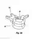 Fig. 22 - Prosthetic spinal disc replacement and methods thereof