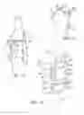 Fig. 07 - Prosthetic having a modular soft tissue fixation mechanism