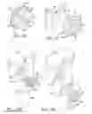 Fig. 08 - Prosthetic having a modular soft tissue fixation mechanism