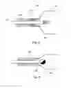 Fig. 05 - Shoulder implant for simulating a bursa
