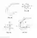 Fig. 05 - Systems and methods for providing a modular femoral component