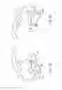 Fig. 07 - Systems and methods for providing a modular femoral component