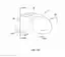 Fig. 11 - Systems and methods for providing a modular femoral component