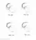 Fig. 20 - Systems and methods for providing a modular femoral component