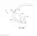 Fig. 28 - Systems and methods for providing a modular femoral component