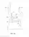 Fig. 32 - Systems and methods for providing a modular femoral component