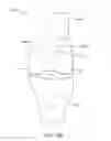 Fig. 52 - Systems and methods for providing a modular femoral component