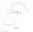 Fig. 62 - Systems and methods for providing a modular femoral component