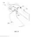 Fig. 64 - Systems and methods for providing a modular femoral component