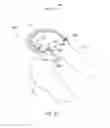 Fig. 67 - Systems and methods for providing a modular femoral component