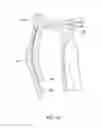 Fig. 69 - Systems and methods for providing a modular femoral component