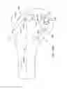 Fig. 74 - Systems and methods for providing a modular femoral component