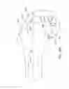 Fig. 75 - Systems and methods for providing a modular femoral component