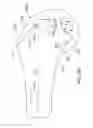 Fig. 76 - Systems and methods for providing a modular femoral component