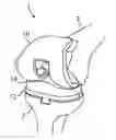 Fig. 01 - KNEE ARTHROPLASTY TIBIA COMPONENT AND KNEE ARTHROPLASTY
