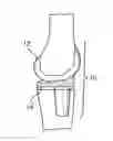Fig. 01 - Systems and methods for providing an asymmetrical tibial component