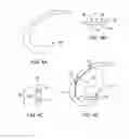 Fig. 05 - Systems and methods for providing an asymmetrical tibial component