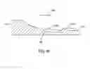 Fig. 10 - Systems and methods for providing an asymmetrical tibial component