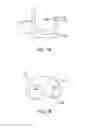 Fig. 14 - Systems and methods for providing an asymmetrical tibial component