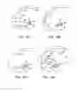 Fig. 27 - Systems and methods for providing an asymmetrical tibial component