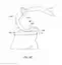 Fig. 38 - Systems and methods for providing an asymmetrical tibial component