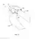 Fig. 64 - Systems and methods for providing an asymmetrical tibial component