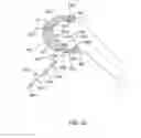 Fig. 65 - Systems and methods for providing an asymmetrical tibial component