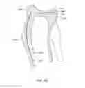Fig. 69 - Systems and methods for providing an asymmetrical tibial component
