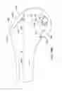 Fig. 75 - Systems and methods for providing an asymmetrical tibial component